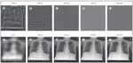 AI recognition of patient race in medical imaging: a modelling study