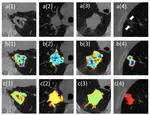 Automatic lung nodule segmentation and intra-nodular heterogeneity image generation