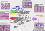 Prostate cancer therapy personalization via multi-modal deep learning on randomized phase III clinical trials