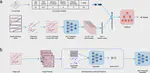Development and validation of a prognostic AI biomarker using multi-modal deep learning with digital histopathology in localized prostate cancer on NRG Oncology phase III clinical trials.