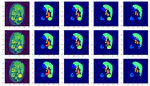 Adapting pre-trained vision transformers from 2D to 3D through weight inflation improves medical image segmentation